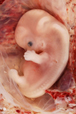 A 9-week old human embryo