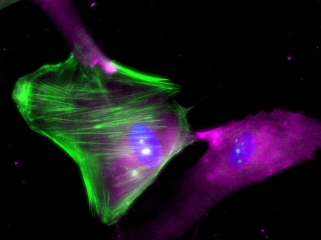 Human retinal pericytes stained with antibodies against α-SMA (green), NG2 (purple) and nuclei stained with DAPI (Jessica Eyre).   