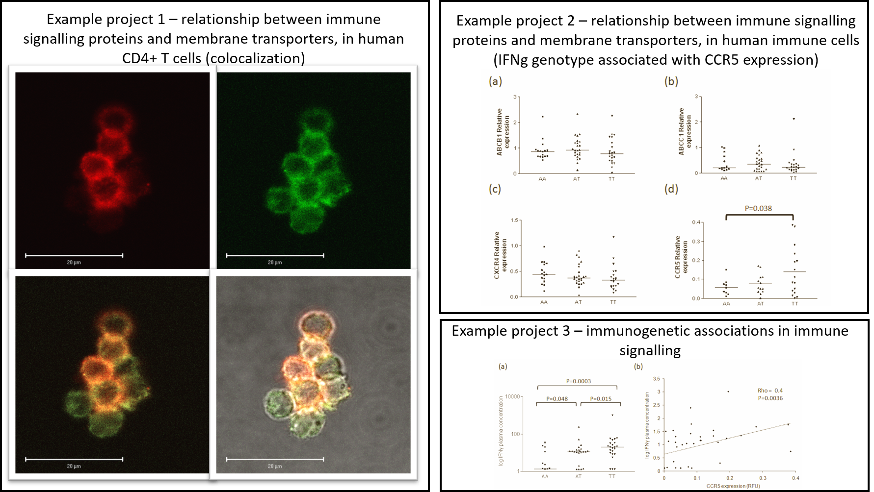 Colocalisation of CXCR4 (green) and ABCB1 (red) in CD4+ T cells. Interaction between, and upregulation of these proteins can affect response to HIV antiretrovirals. We have shown previously that they are influenced by immune signalling and, colocalised in the cell membrane.